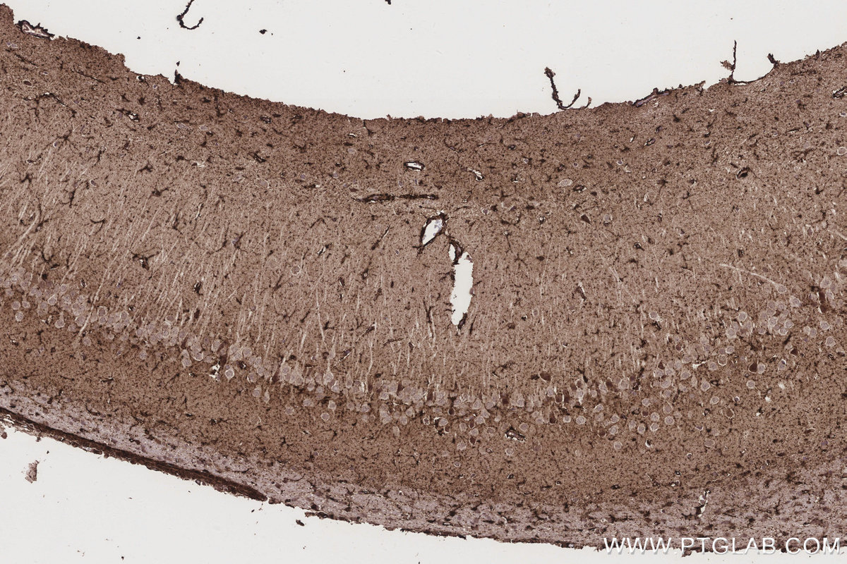 IHC staining of rat brain using 17925-1-AP IHC staining of rat brain using 17925-1-AP
