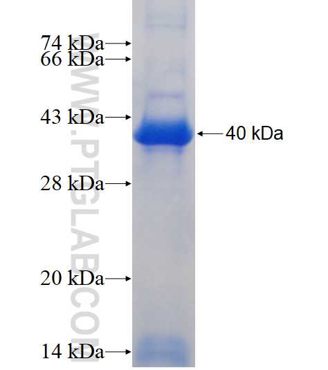 ETFDH fusion protein Ag17921 SDS-PAGE ETFDH fusion protein Ag17921 SDS-PAGE