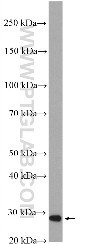 WB analysis of BGC-823 using 27786-1-AP