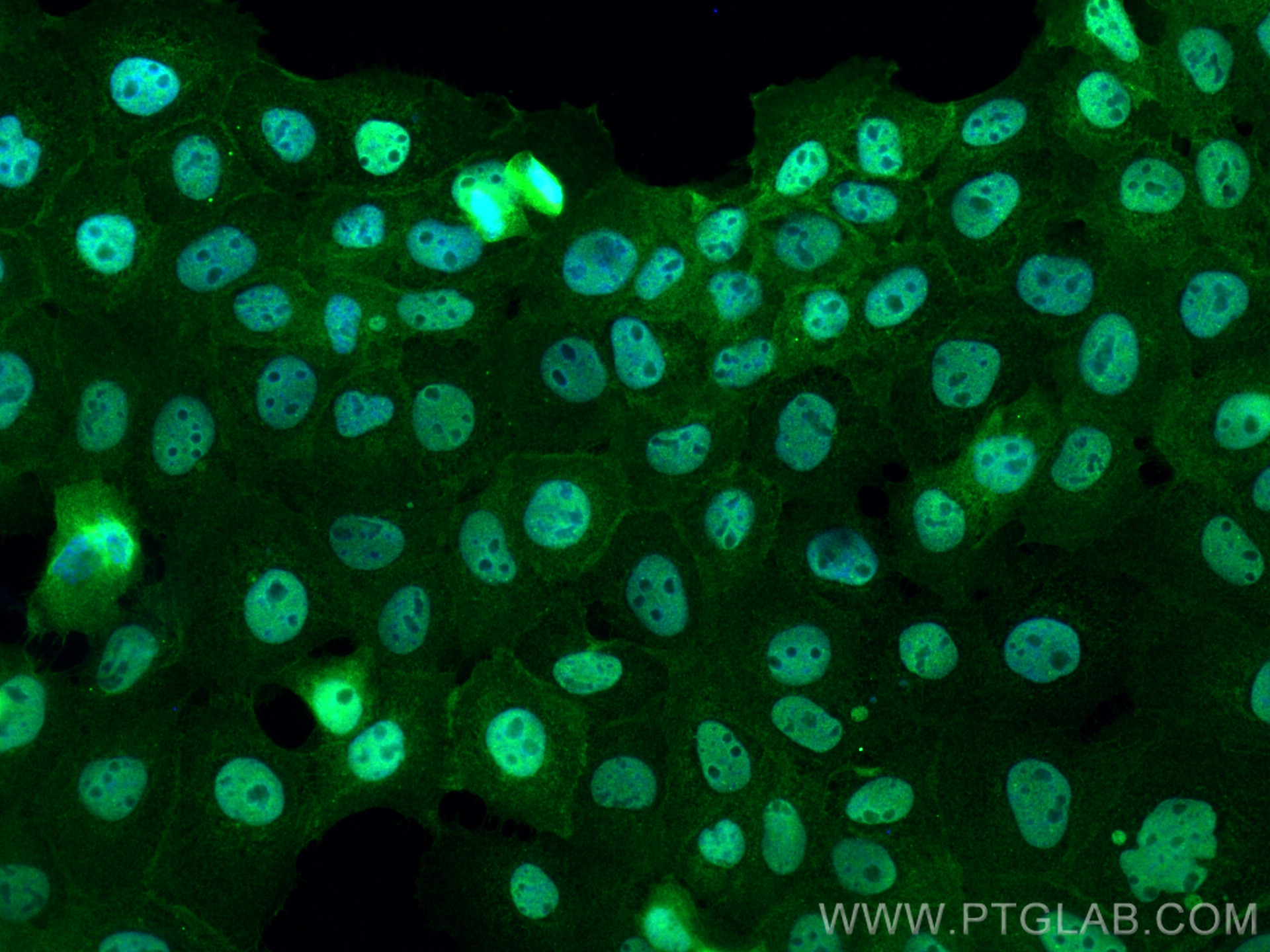 IF Staining of A431 using 12118-1-AP (same clone as 12118-1-PBS)
