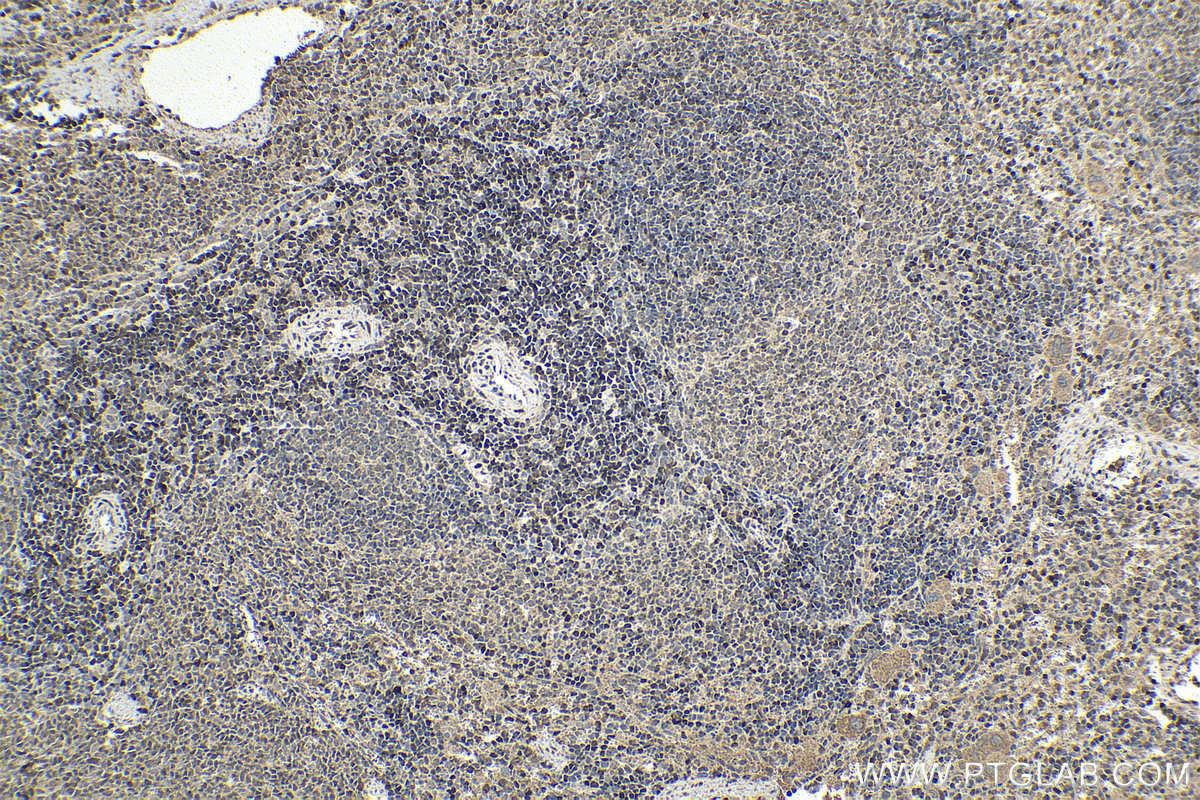 IHC staining of rat spleen using 12118-1-AP