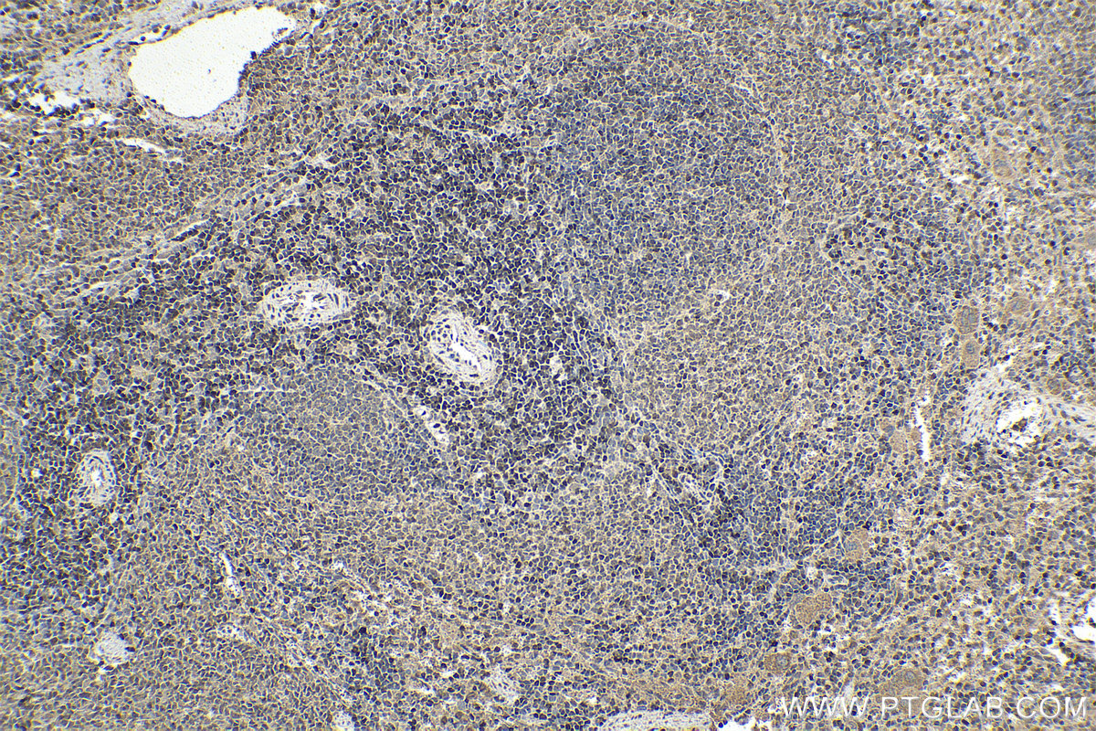 IHC staining of rat spleen using 12118-1-AP (same clone as 12118-1-PBS)