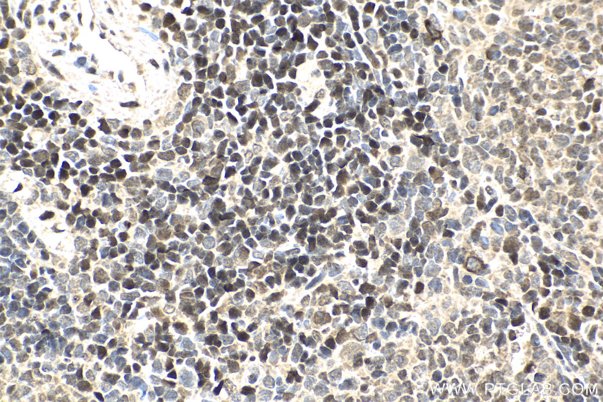 IHC staining of rat spleen using 12118-1-AP