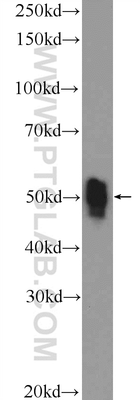 ETS1 Polyclonal antibody