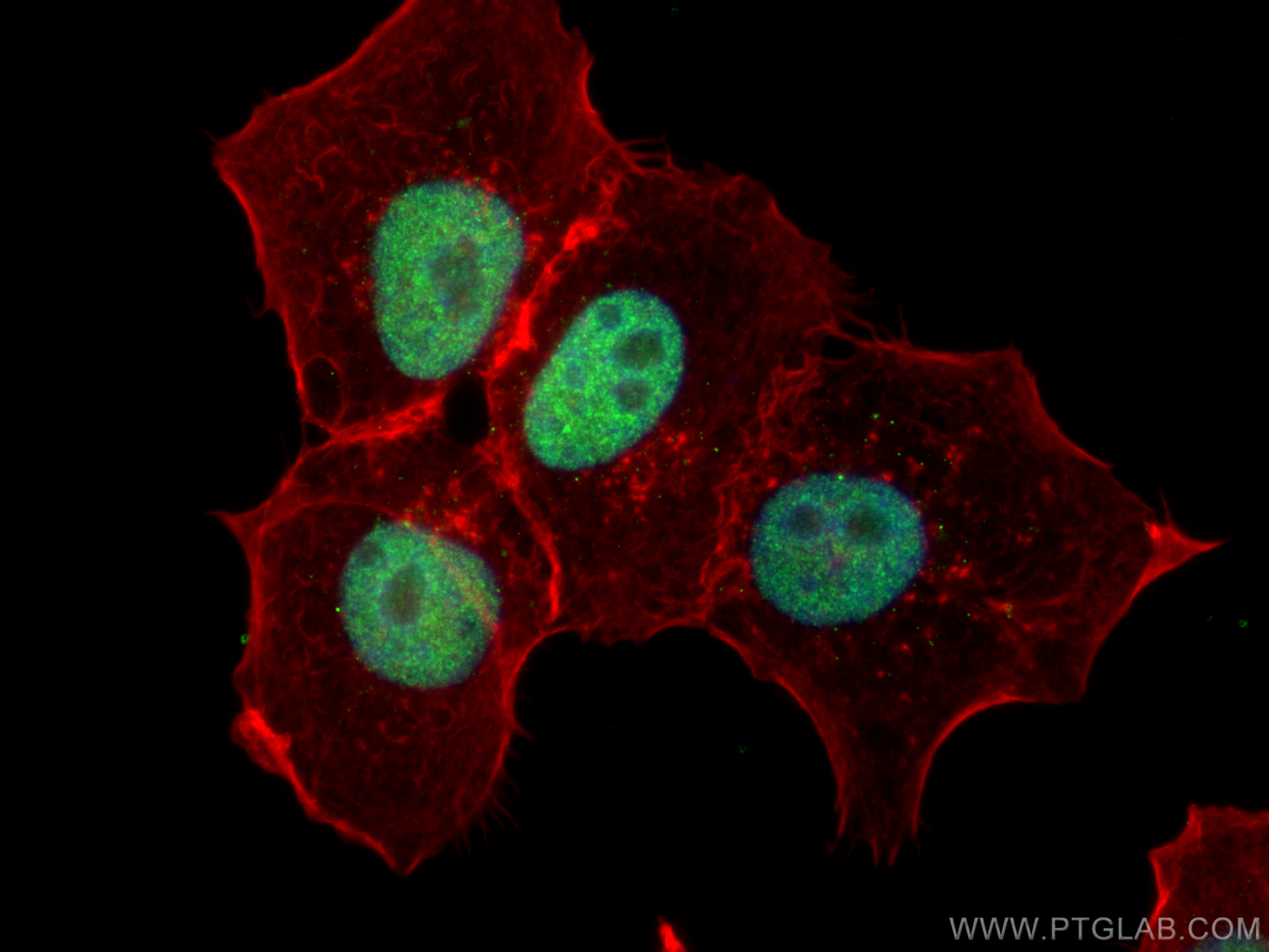 IF Staining of A431 using 66598-1-Ig (same clone as 66598-1-PBS)
