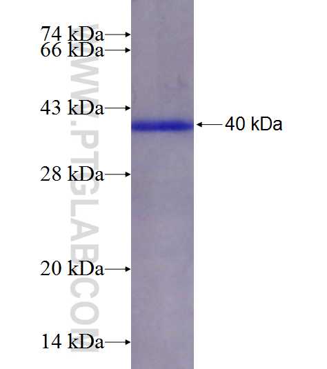 ETS1 fusion protein Ag2127 SDS-PAGE