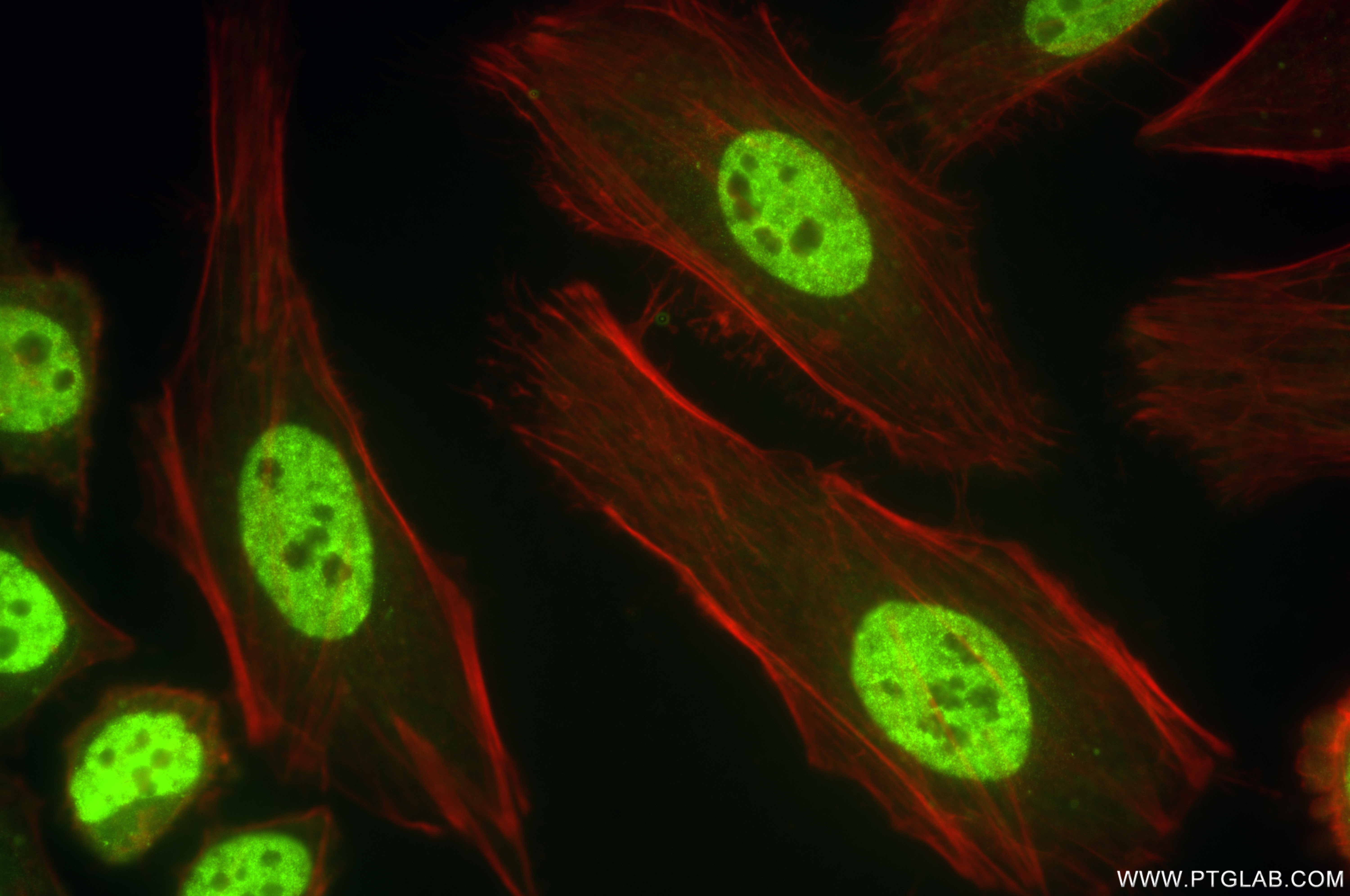IF Staining of HeLa using 85113-4-RR (same clone as 85113-4-PBS)