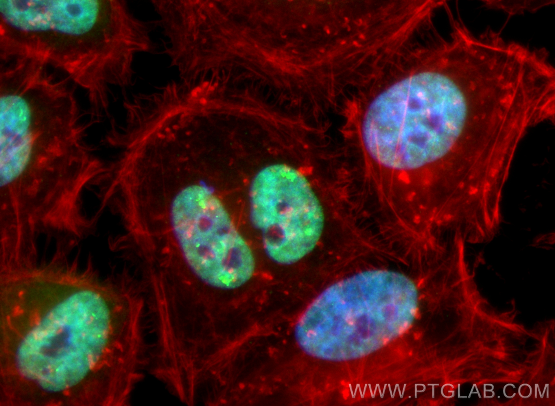 IF Staining of HeLa using CL488-85113-4
