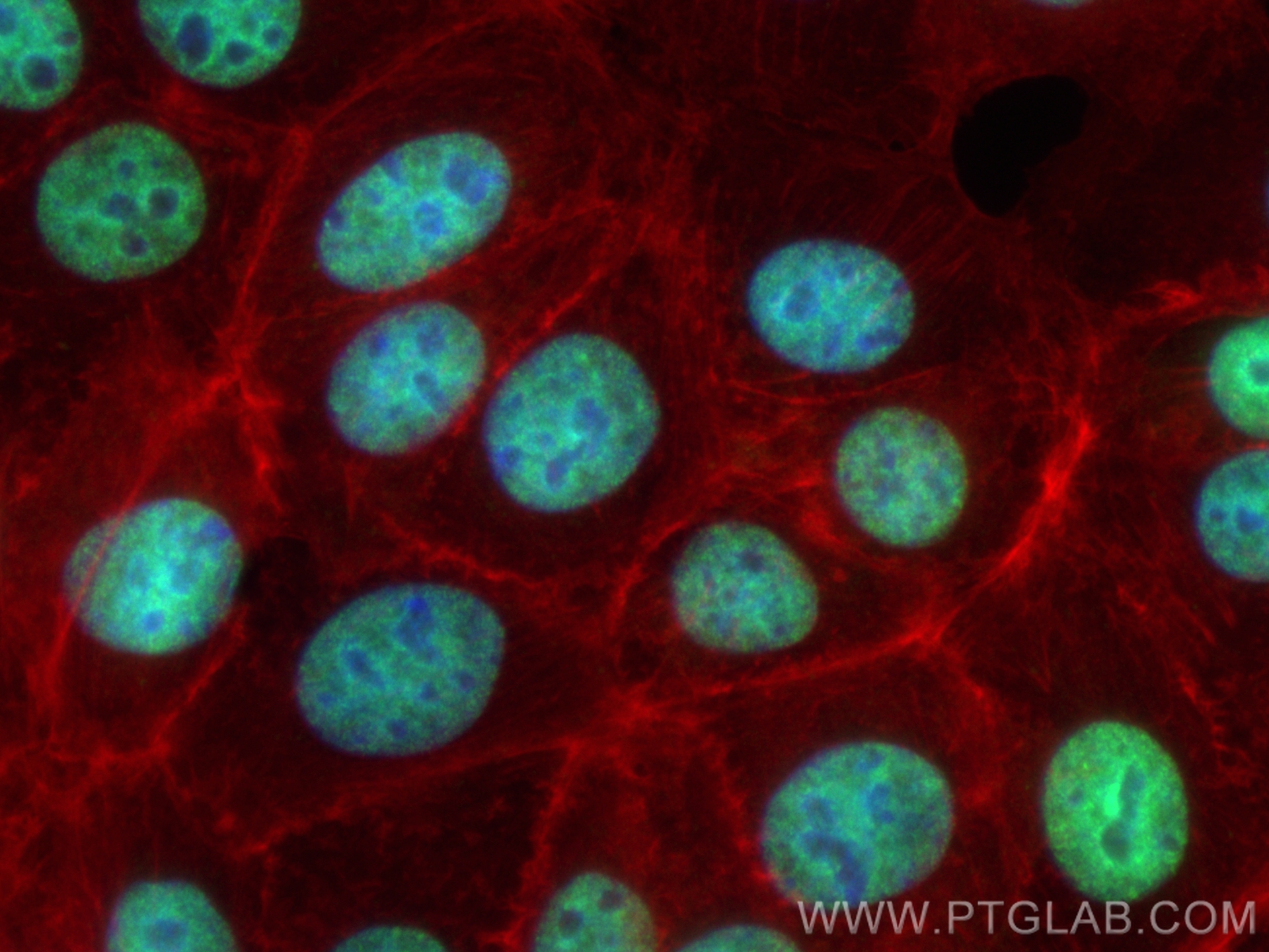 IF Staining of MCF-7 using CL488-85113-4
