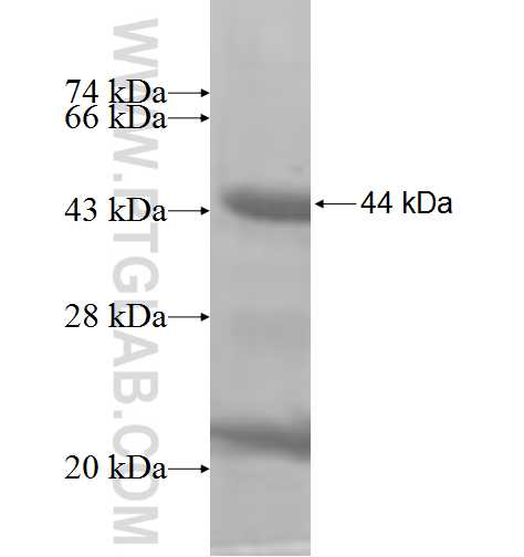 ETV1 fusion protein Ag10020 SDS-PAGE ETV1 fusion protein Ag10020 SDS-PAGE