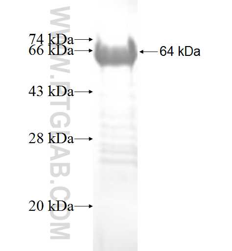 ETV1 fusion protein Ag9692 SDS-PAGE ETV1 fusion protein Ag9692 SDS-PAGE