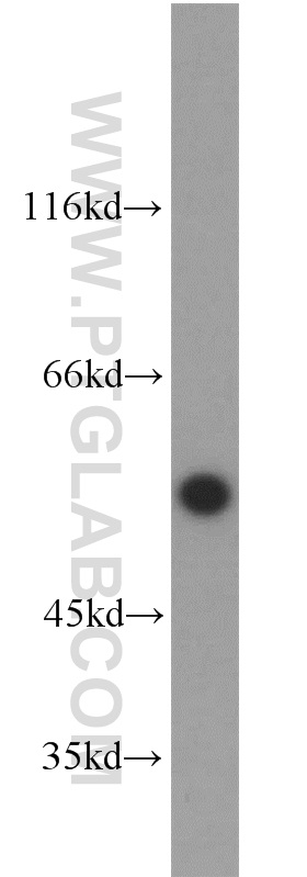 WB analysis of mouse heart using 10684-1-AP