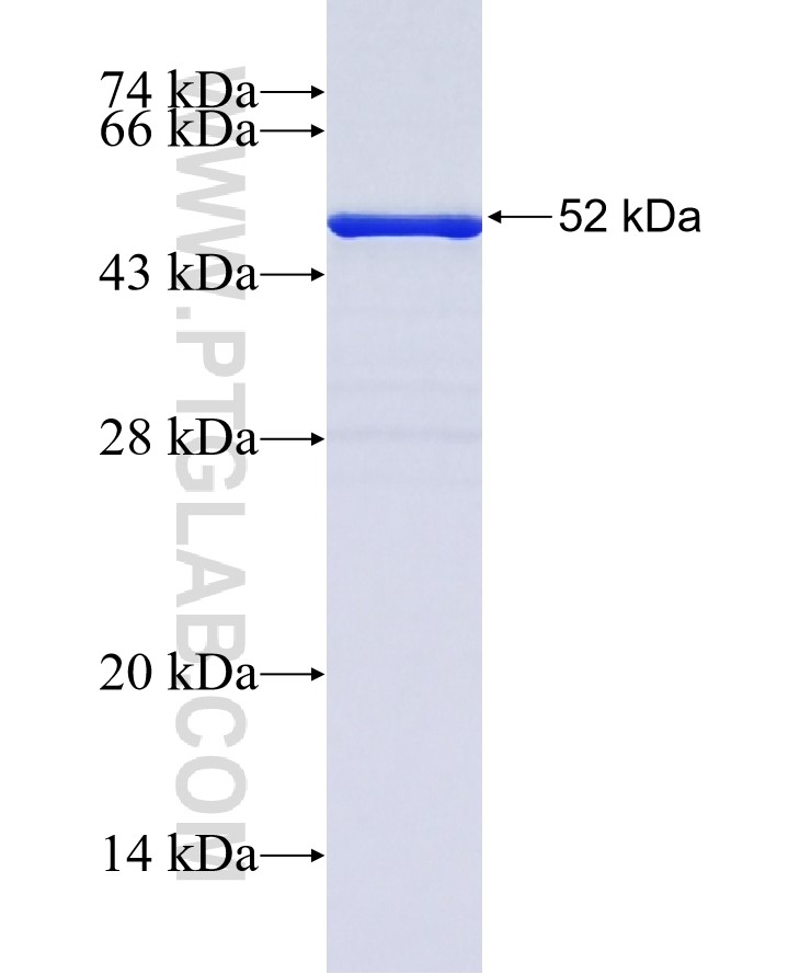 ETV4 fusion protein Ag0984 SDS-PAGE