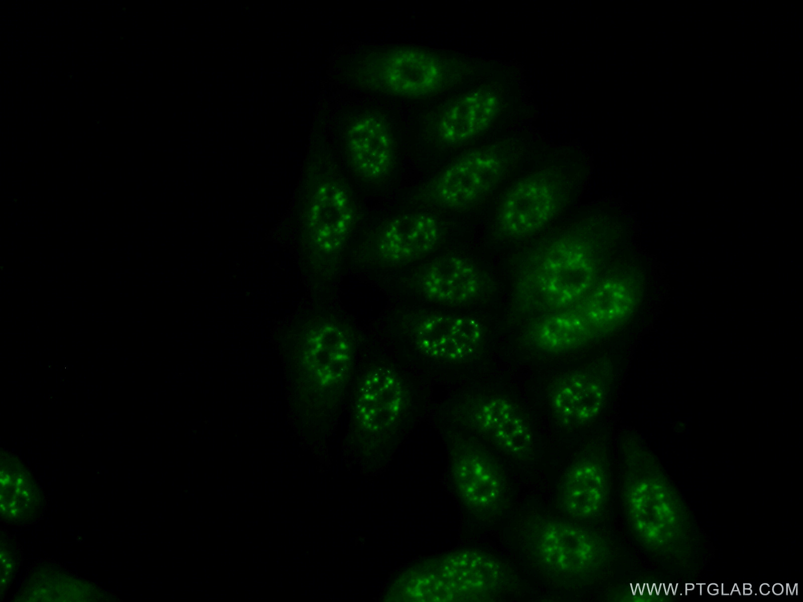 IF Staining of PC-3 using 13011-1-AP