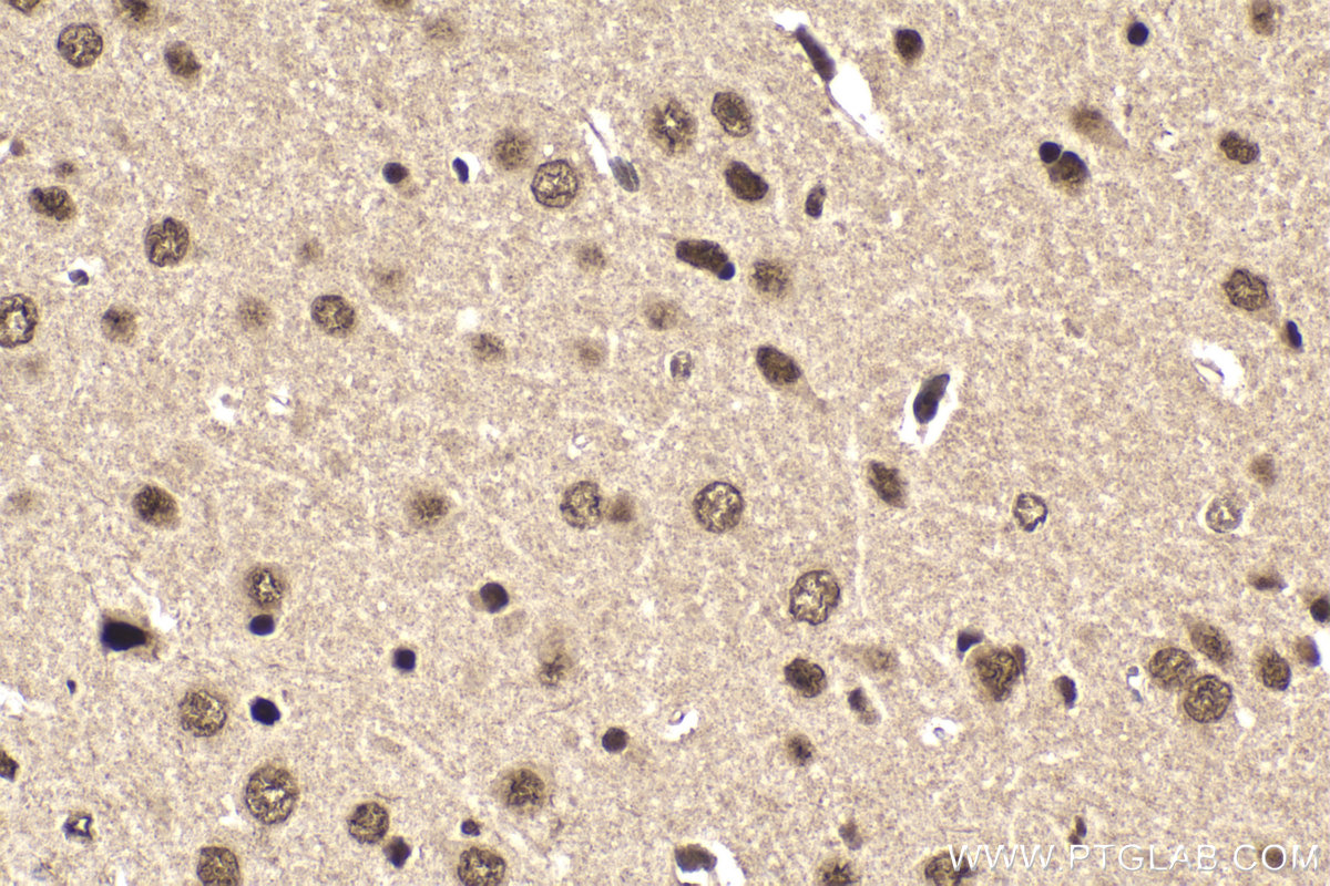 IHC staining of mouse brain using 13011-1-AP