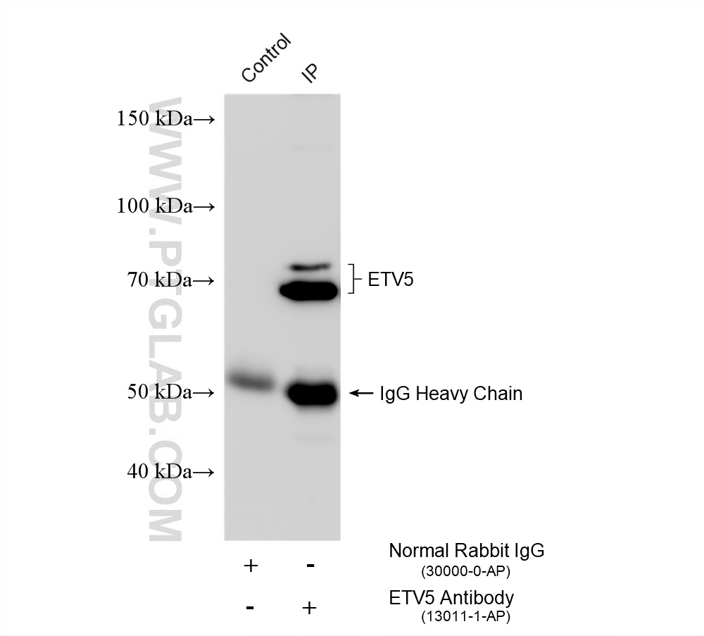 IP experiment of HeLa using 13011-1-AP IP experiment of HeLa using 13011-1-AP