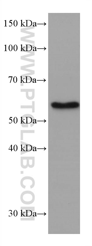 WB analysis of Jurkat using 67579-1-Ig