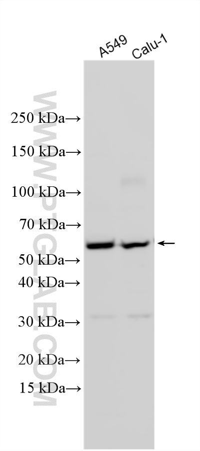 WB analysis using 24891-1-AP