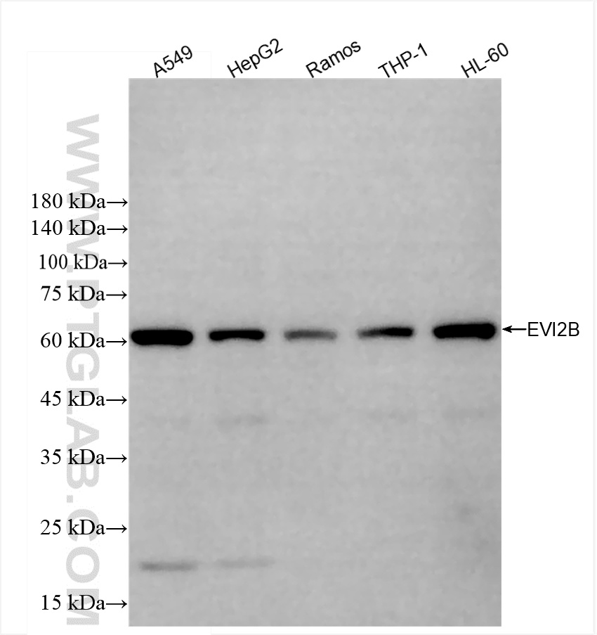 WB analysis using 85943-1-RR (same clone as 85943-1-PBS)