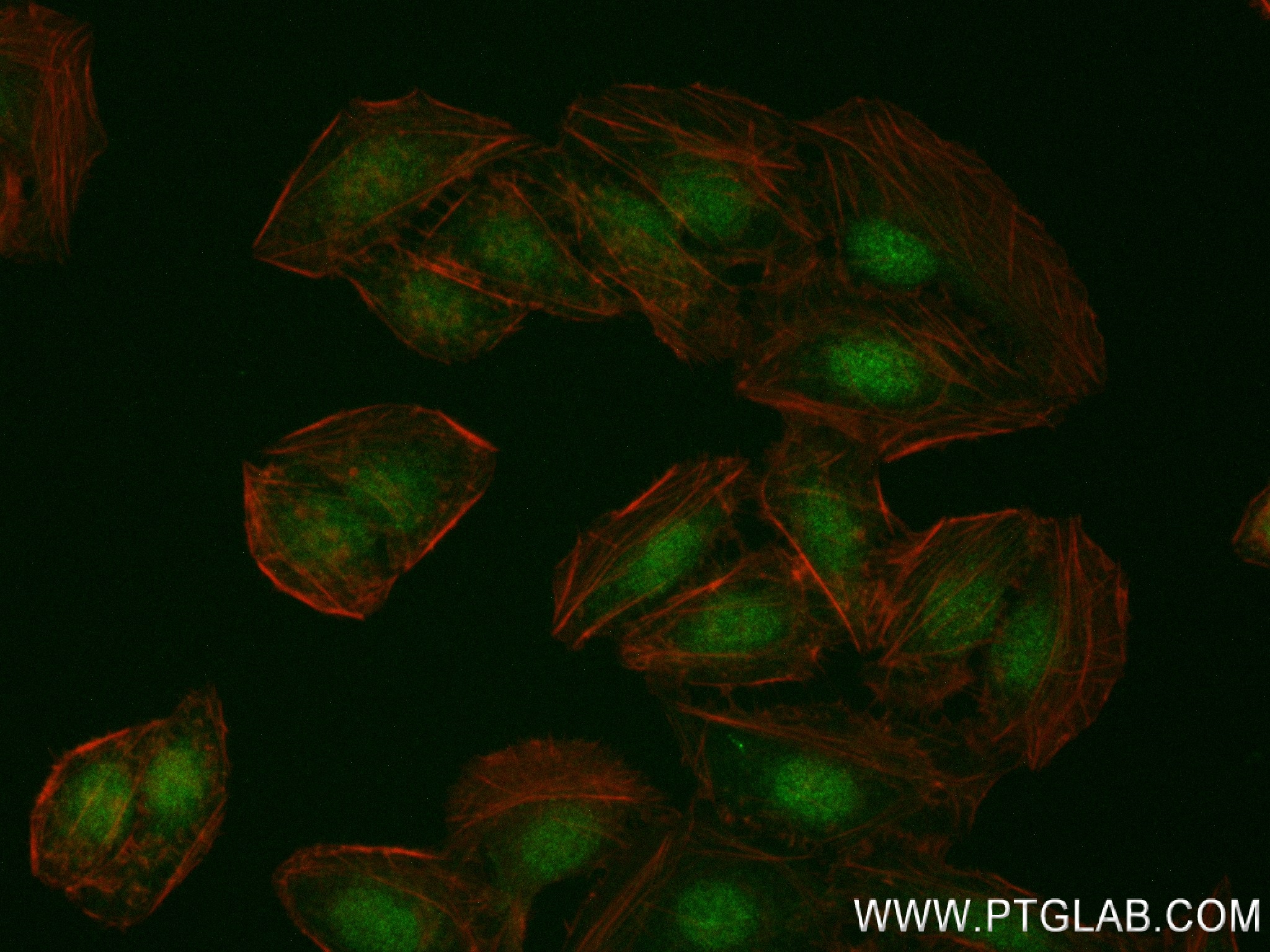 IF Staining of U2OS using 84738-2-RR