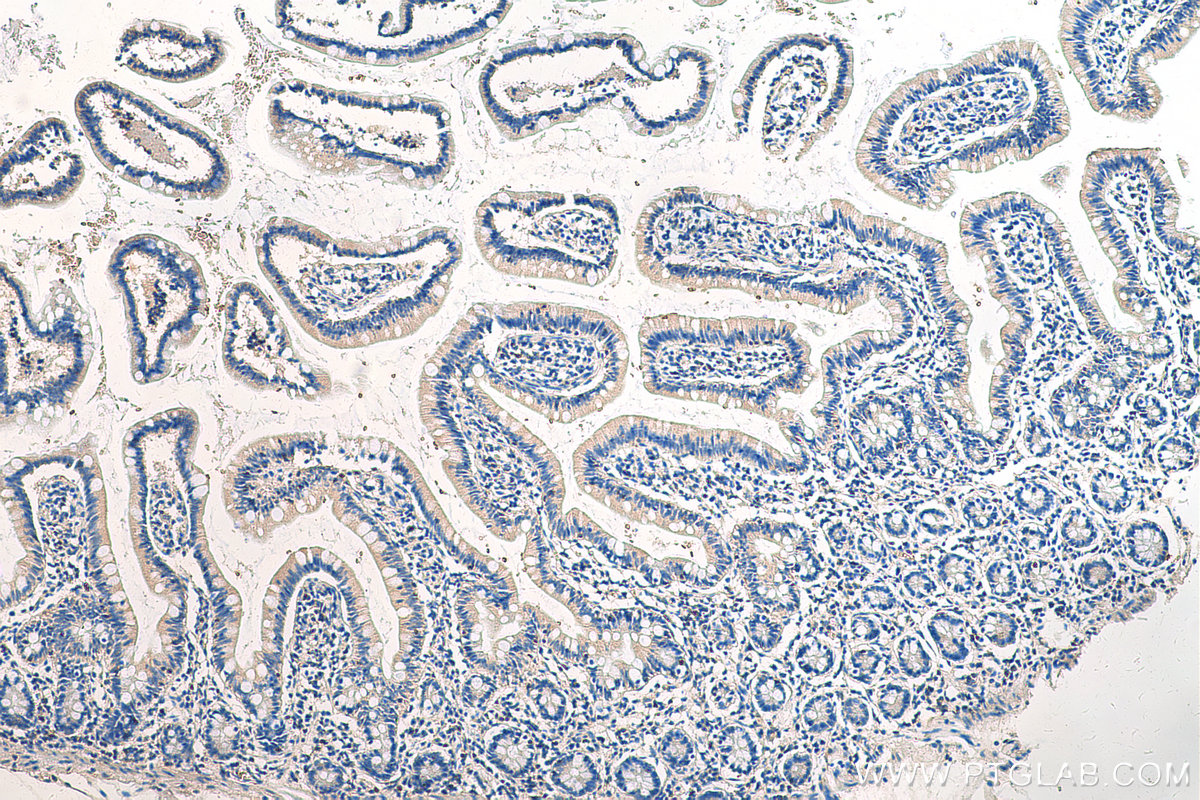 IHC staining of human small intestine using 13484-1-AP (same clone as 13484-1-PBS)
