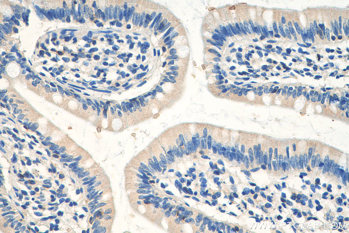 IHC staining of human small intestine using 13484-1-AP (same clone as 13484-1-PBS)