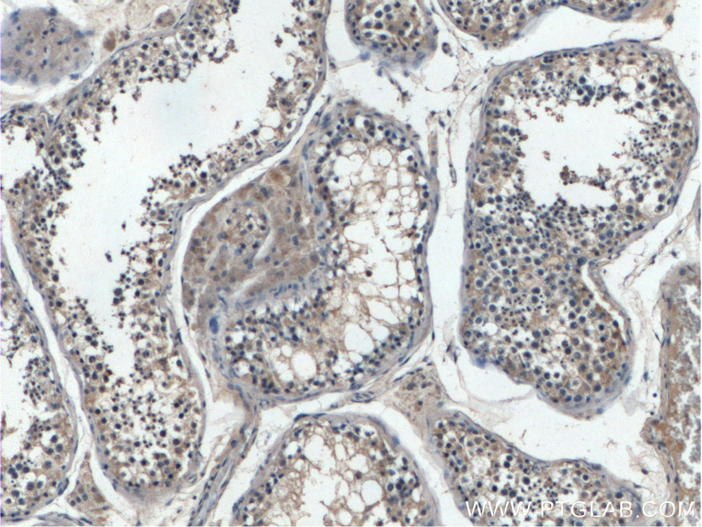 IHC staining of human testis using 17313-1-AP