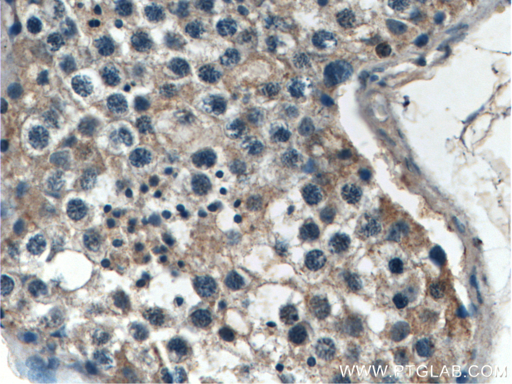 IHC staining of human testis using 17313-1-AP