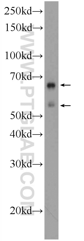 WB analysis of SH-SY5Y using 17313-1-AP