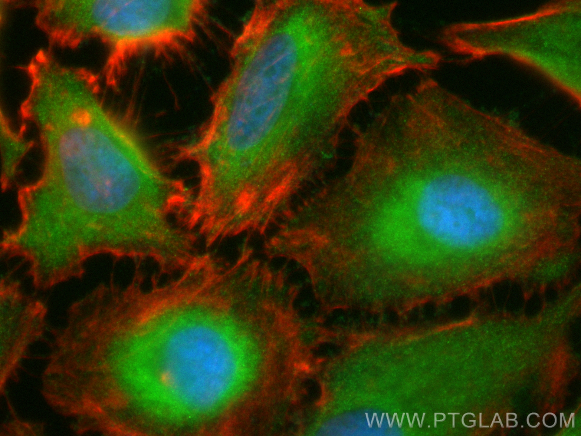 IF Staining of HeLa using CL488-17313