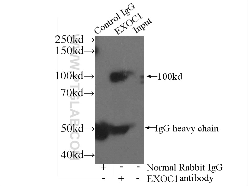 IP experiment of mouse brain using 11690-1-AP