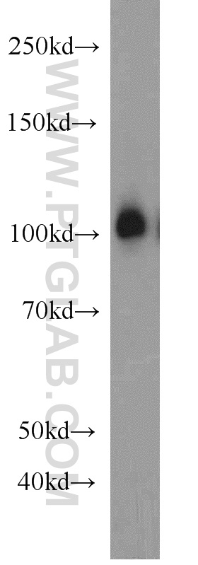 EXOC1 Polyclonal antibody