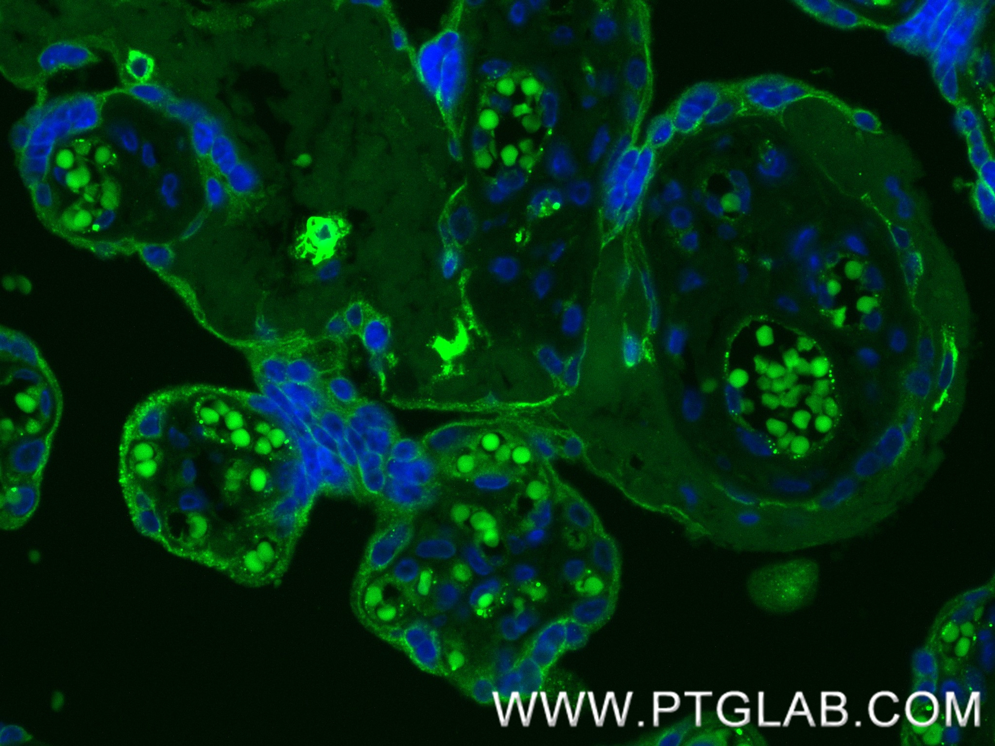 IF Staining of human placenta using 84007-5-RR