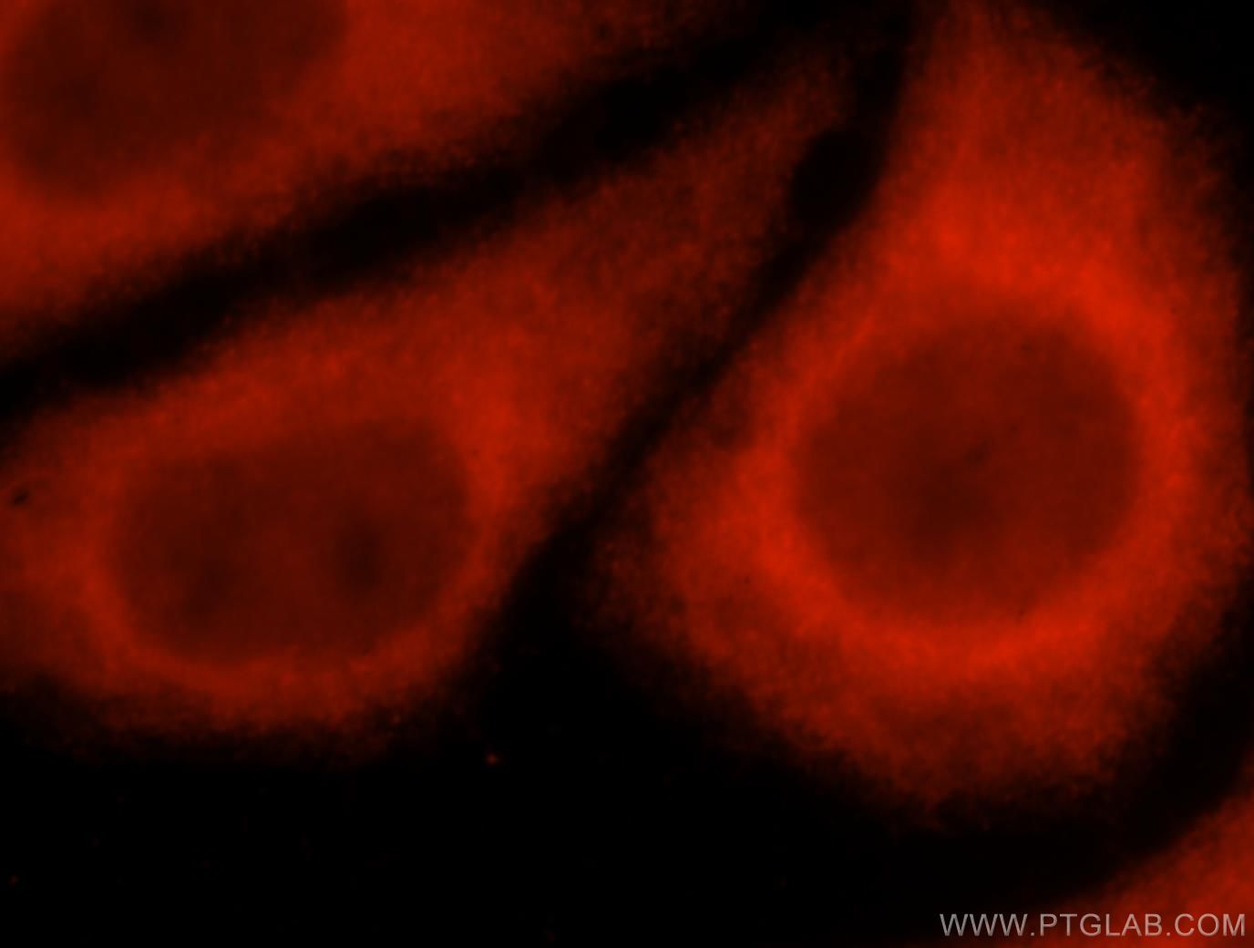 IF Staining of HepG2 using 17593-1-AP