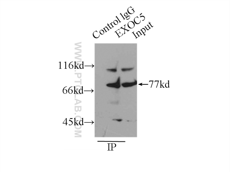 IP experiment of mouse brain using 17593-1-AP