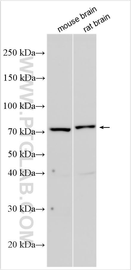 WB analysis using 17593-1-AP