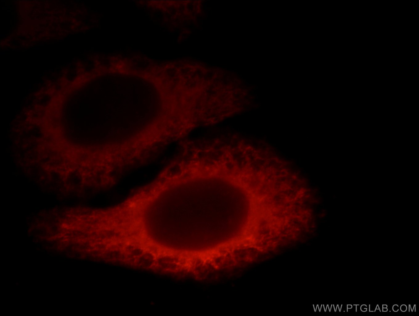 IF Staining of HepG2 using 12723-1-AP