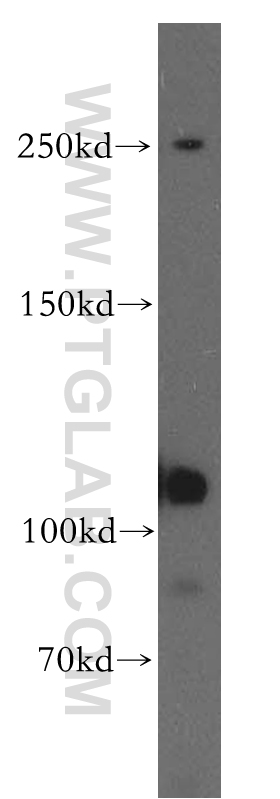 WB analysis of human testis using 12723-1-AP