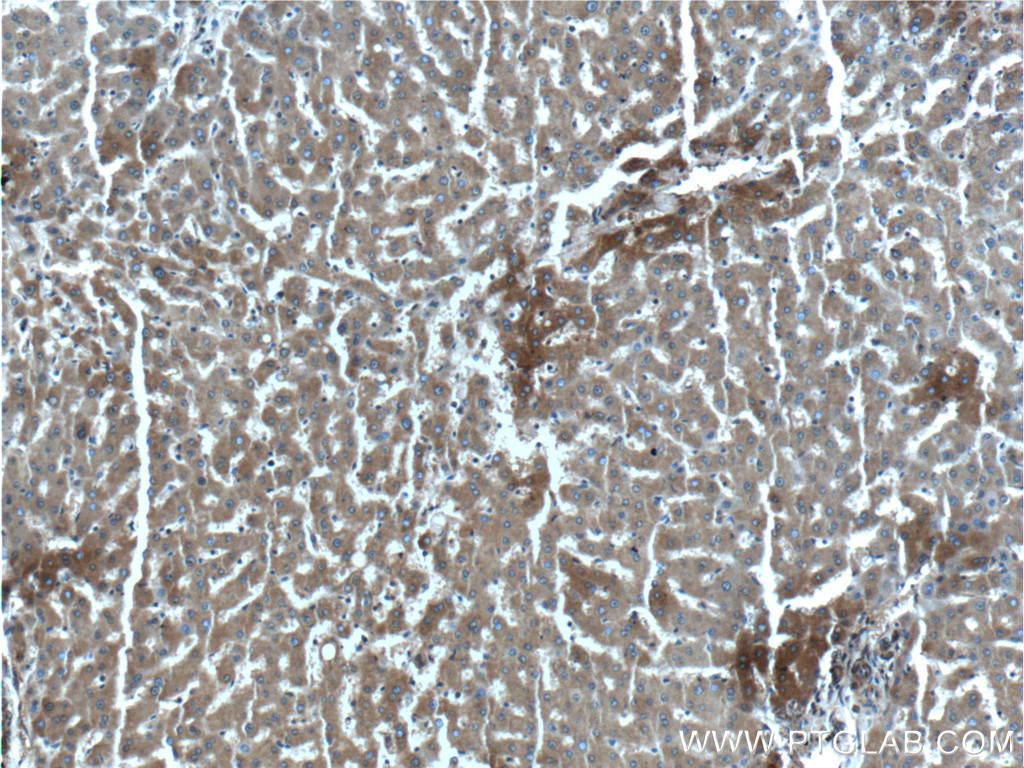 IHC staining of human liver using 55440-1-AP
