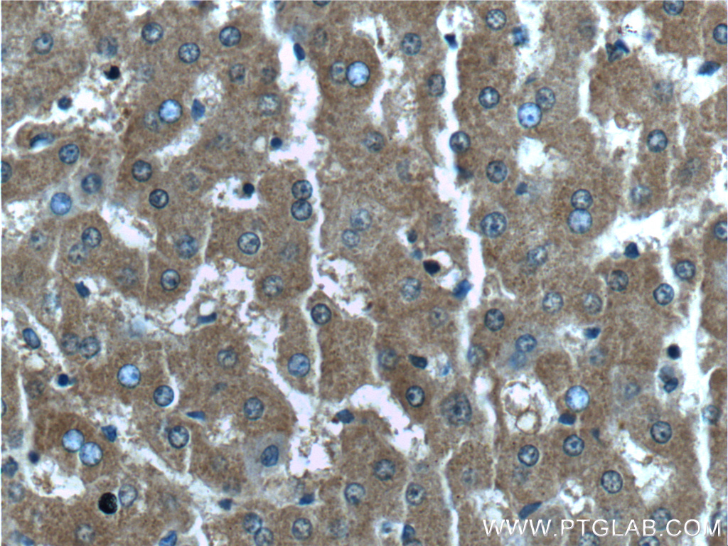IHC staining of human liver using 55440-1-AP