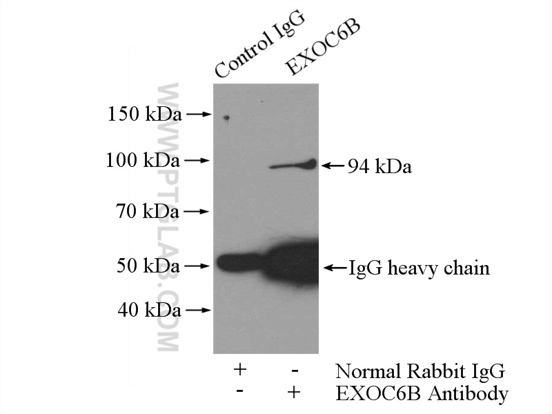 IP experiment of HEK-293 using 55440-1-AP