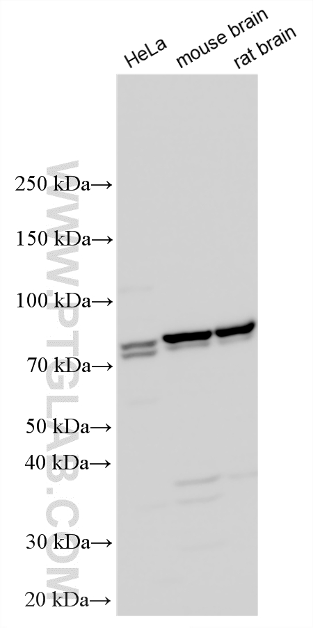 Various lysates were subjected to SDS PAGE followed by western blot with 12014-1-AP (Exo70 antibody) at dilution of 1:3000 incubated at room temperature for 1.5 hours. WB analysis using 12014-1-AP