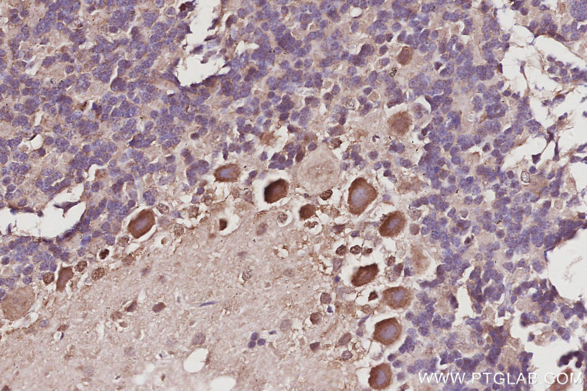 IHC staining of rat cerebellum using 12585-1-AP