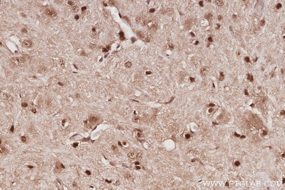 IHC staining of rat cerebellum using 12585-1-AP