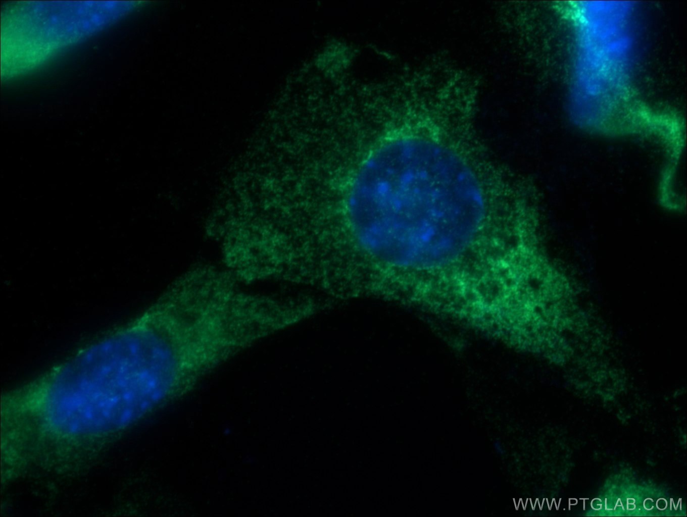 IF Staining of NIH/3T3 using 11178-1-AP