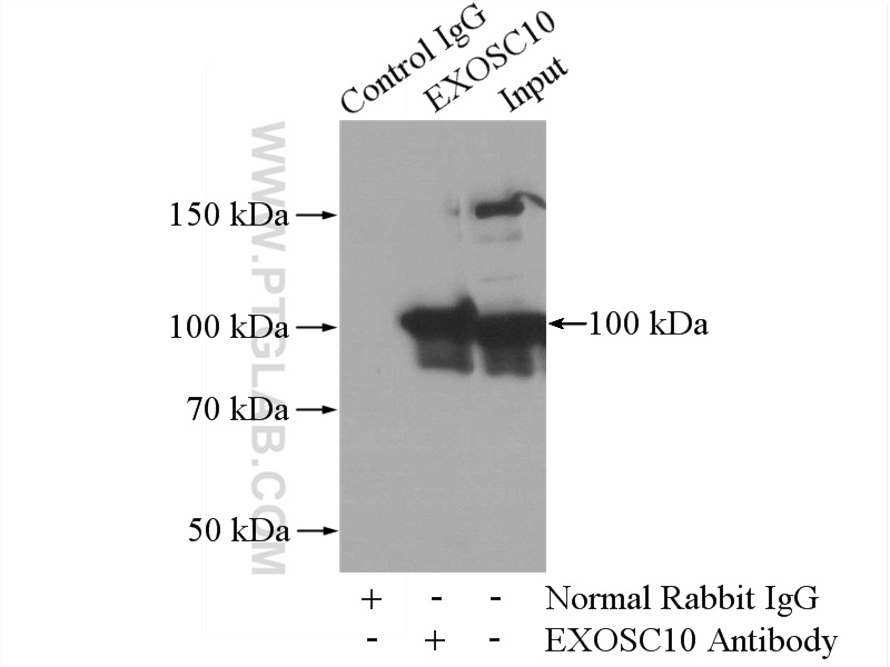 IP experiment of HeLa using 16731-1-AP