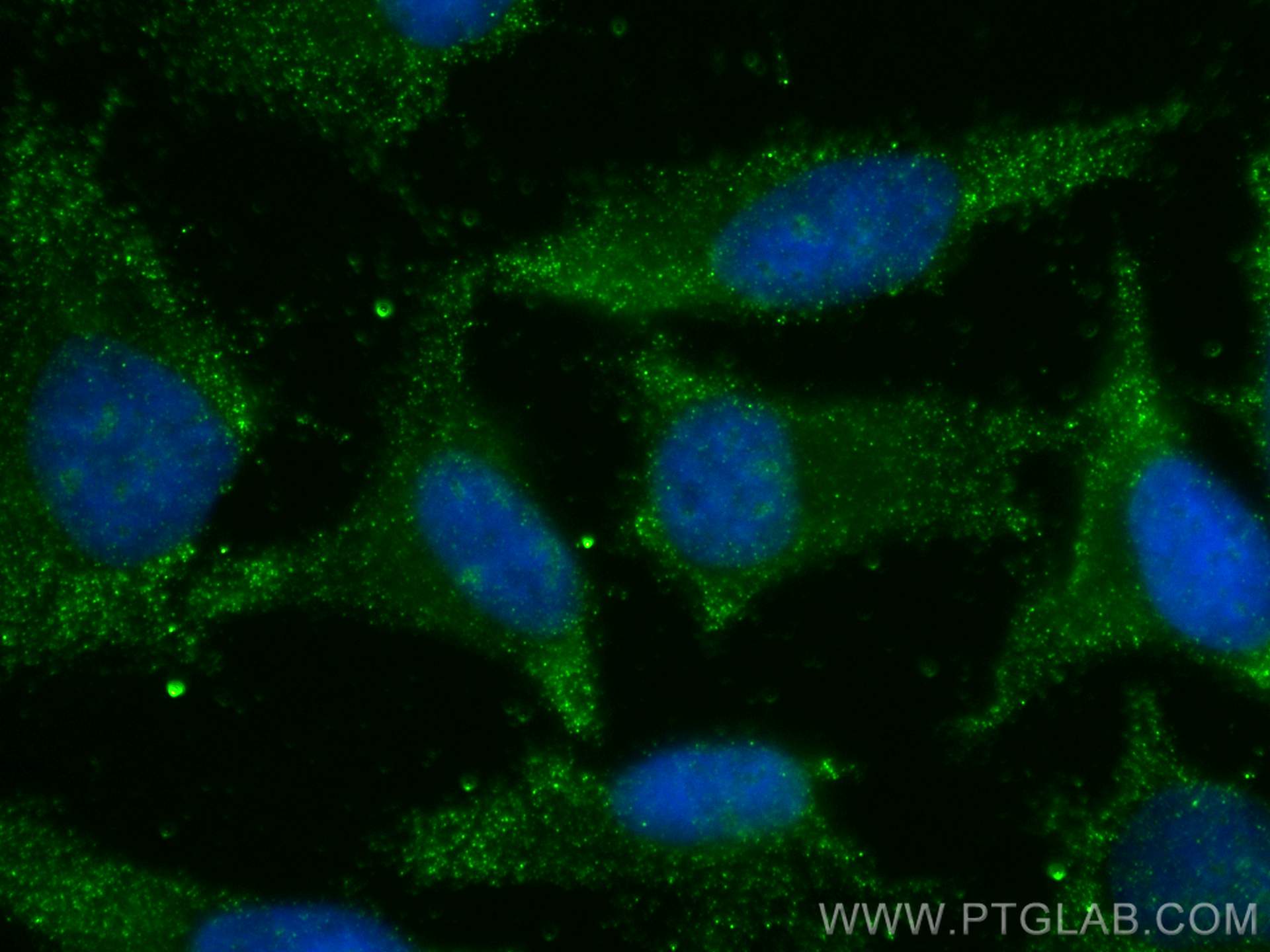 IF Staining of HeLa using 68315-1-Ig