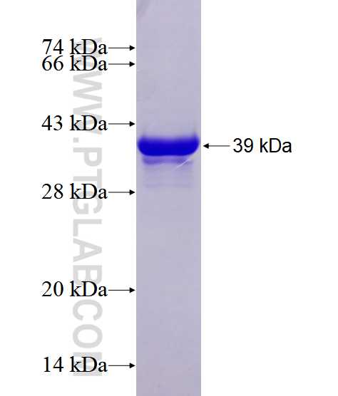 EXOSC10 fusion protein Ag28587 SDS-PAGE