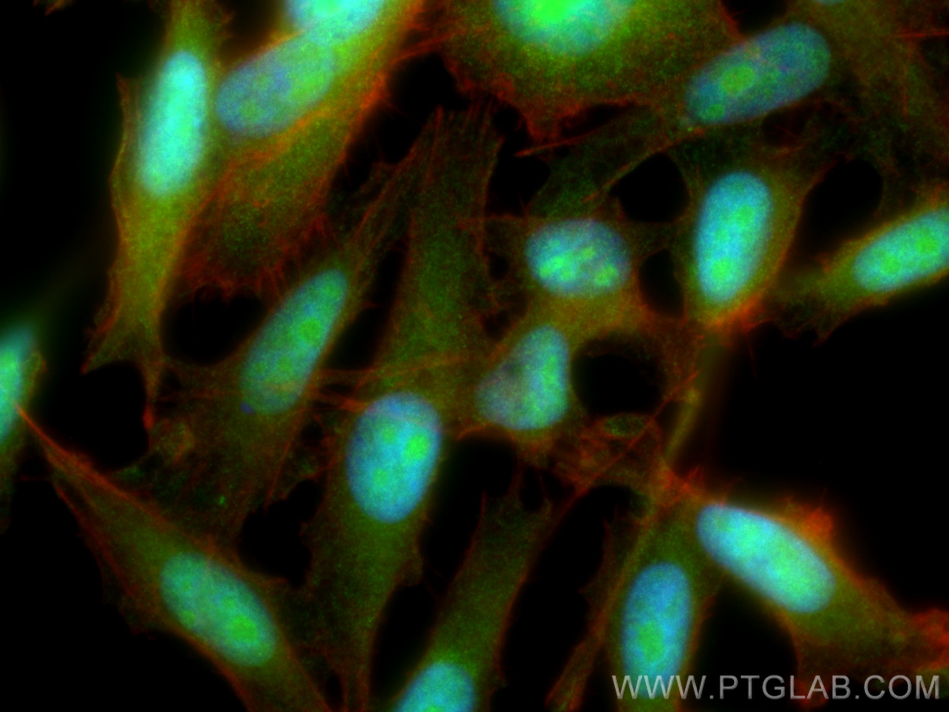 IF Staining of PC-3 using 15062-1-AP