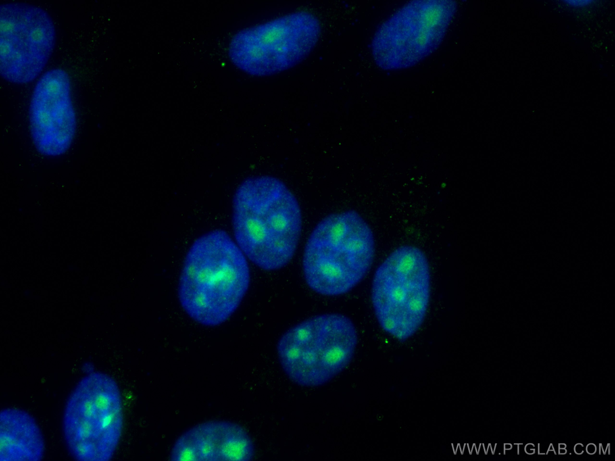 IF Staining of HepG2 using 15937-1-AP